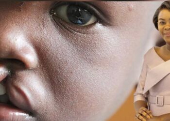 Fentes labio-palatines : une vaste campagne de consultations et d’opérations gratuites lancée au Gabon grâce à Zita Oligui Nguema