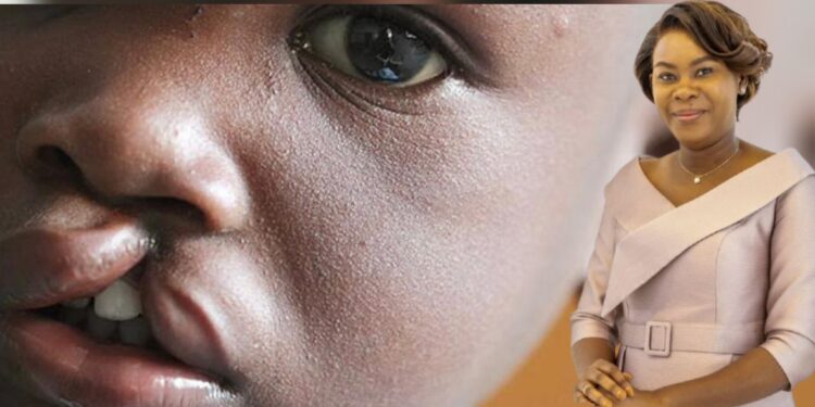 Fentes labio-palatines : une vaste campagne de consultations et d’opérations gratuites lancée au Gabon grâce à Zita Oligui Nguema